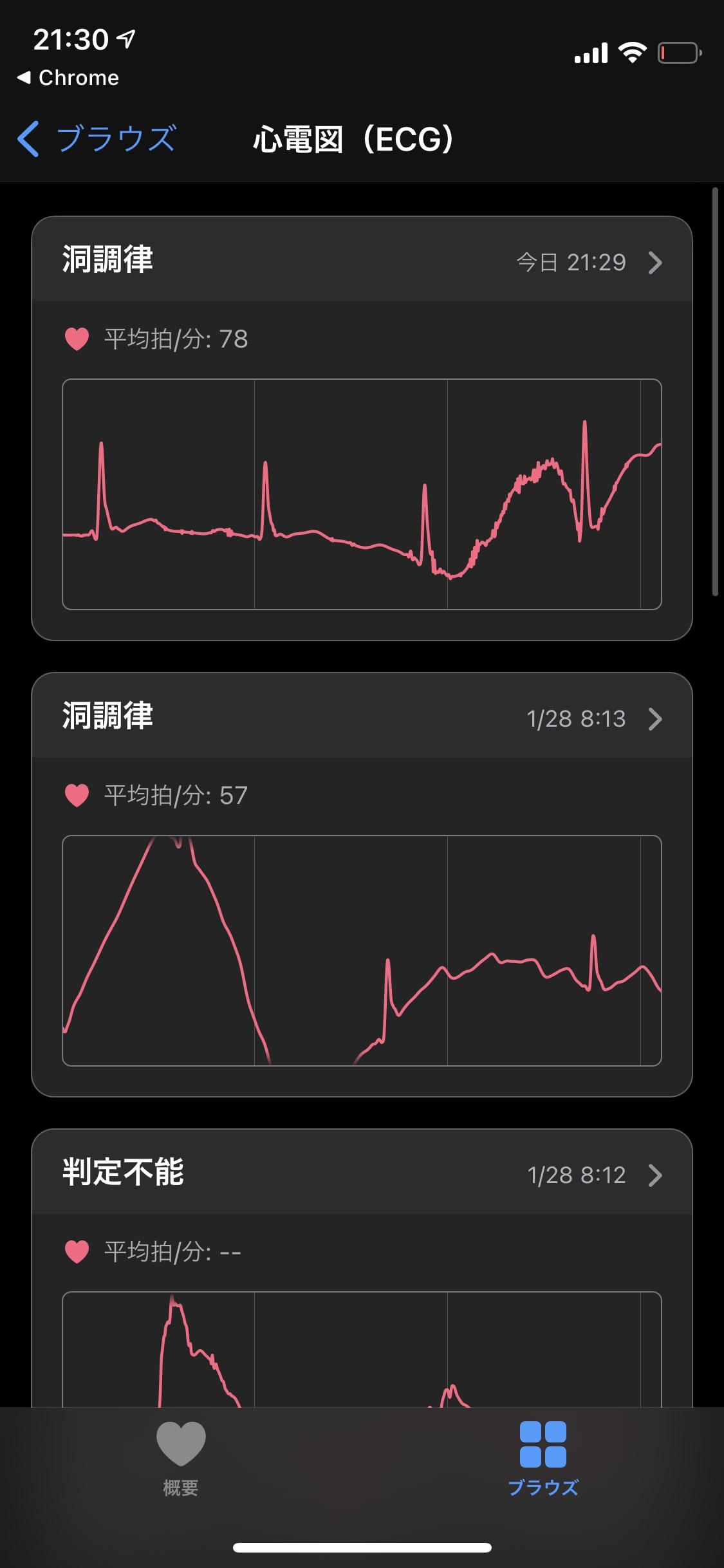 　Apple Watchの電気心拍センサーアプリ画面